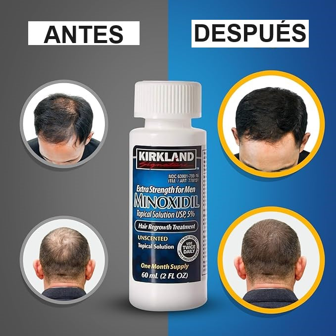 Minoxdil Kirkland 60ml Crecimiento Cabello Extrafuerte Usp5%